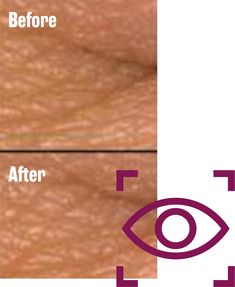 skin prima e dopo
